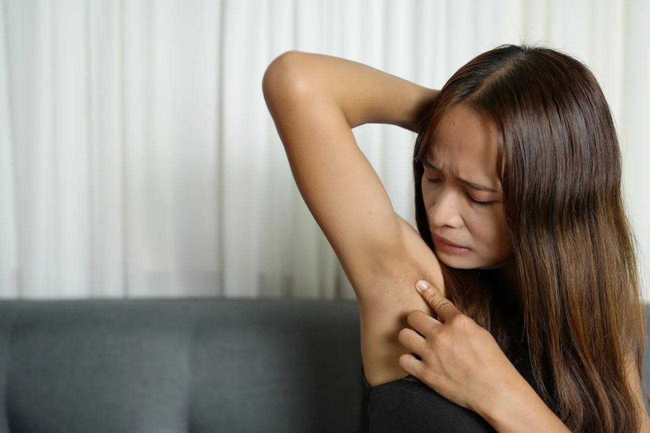 woman with symptoms who may qualify for a hidradenitis suppurativa research study