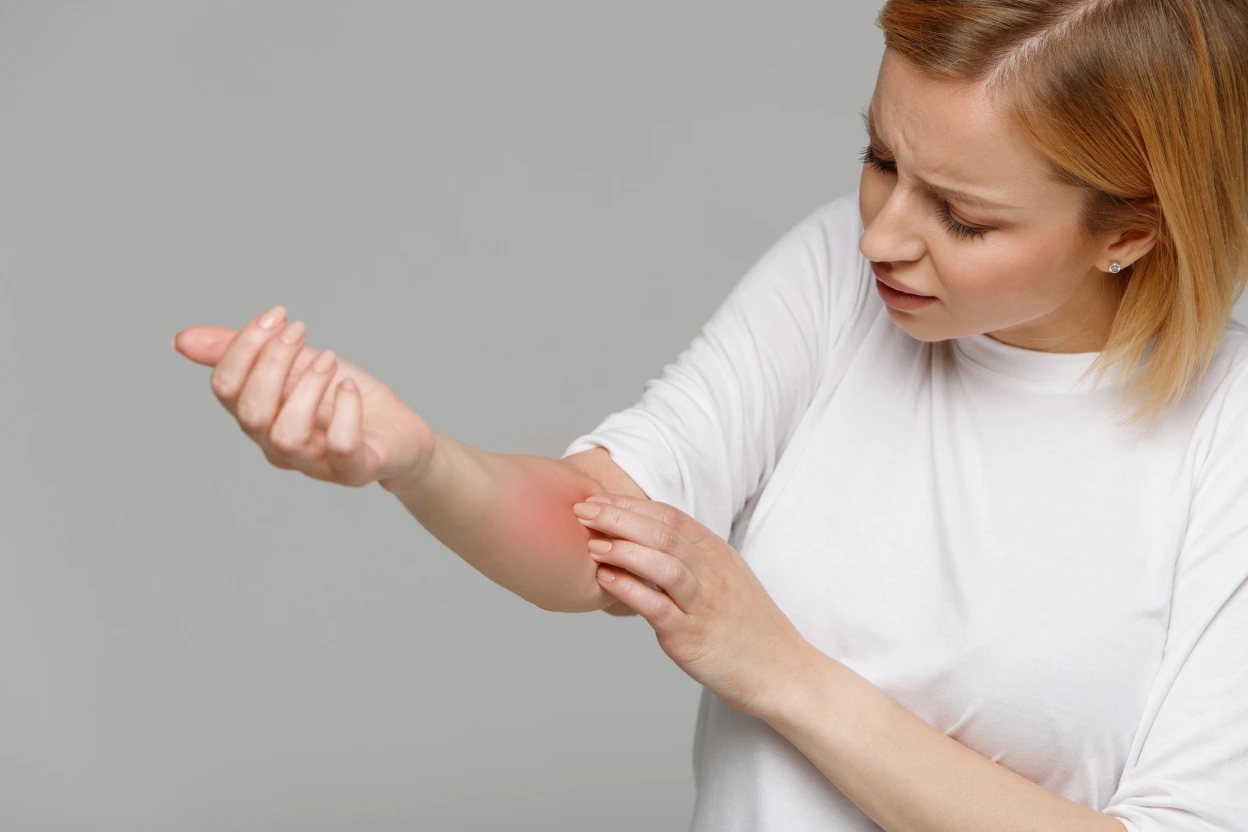 woman with symptoms who may qualify for a psoriasis research study