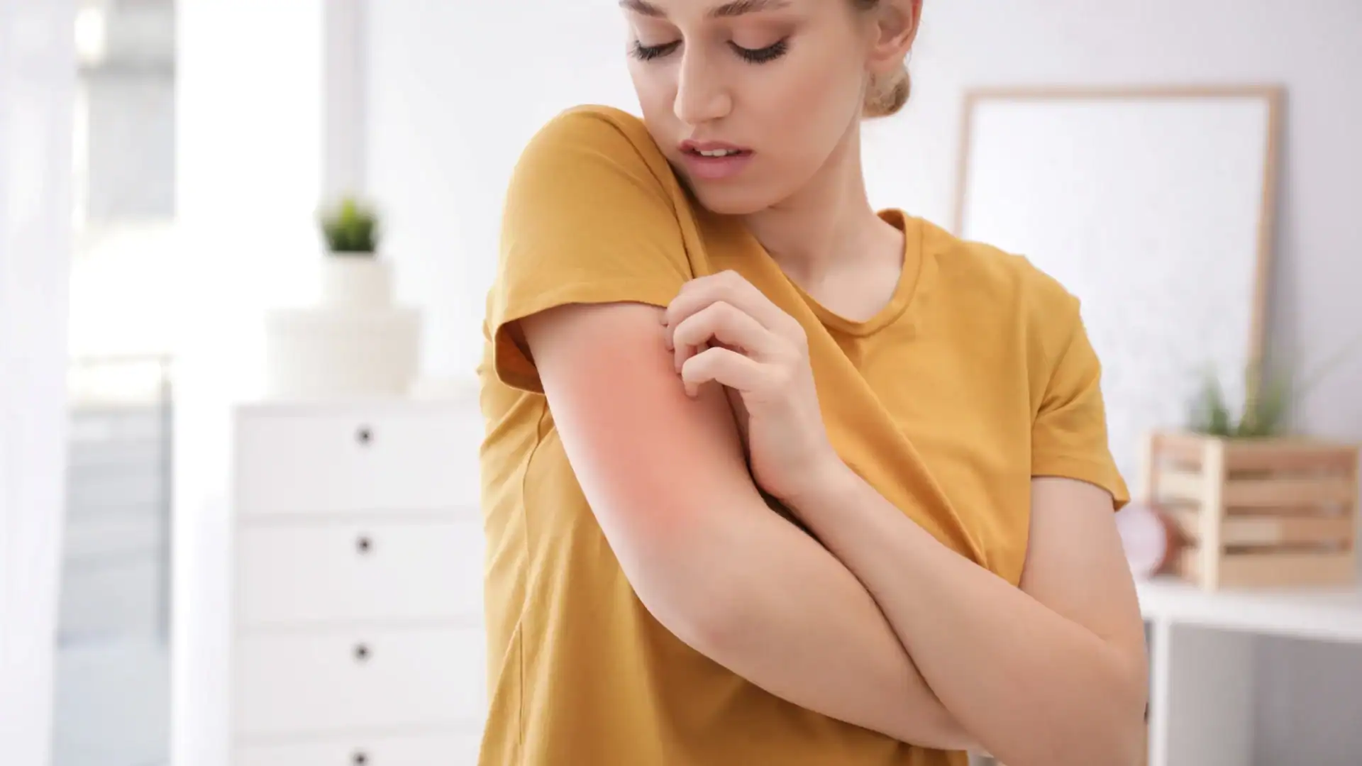 woman with symptoms who may qualify for an eczema clinical research study