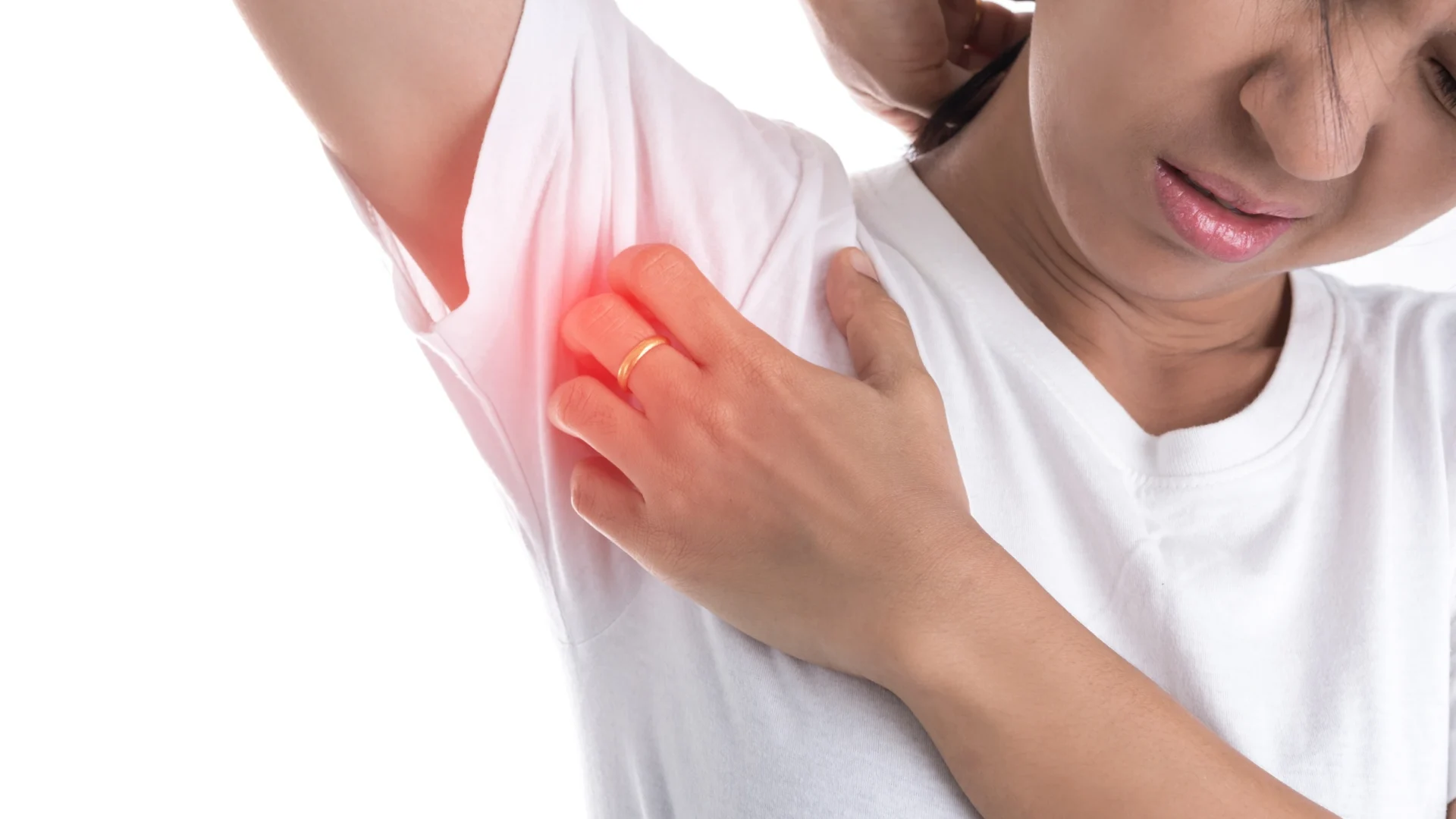 symptoms that would qualify for a hidradenitis suppurativa clinical study