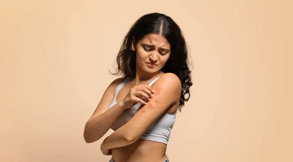 woman with symptoms who may qualify for skin conditions clinical trials